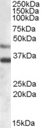 ARSB / Arylsulfatase B Antibody - Antibody (0.03 ug/ml) staining of Human Heart lysate (35 ug protein in RIPA buffer). Primary incubation was 1 hour. Detected by chemiluminescence.