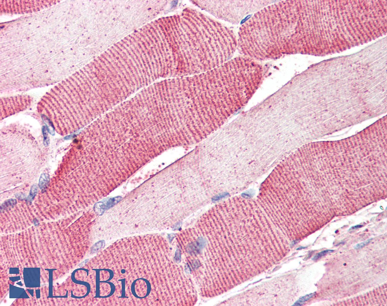 ARSB / Arylsulfatase B Antibody - Anti-ARSB antibody IHC of human skeletal muscle. Immunohistochemistry of formalin-fixed, paraffin-embedded tissue after heat-induced antigen retrieval. Antibody concentration 5 ug/ml.
