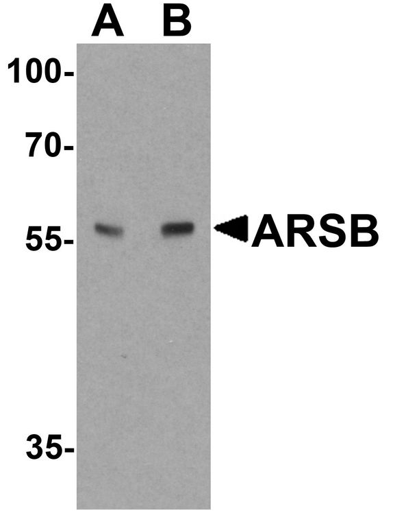 ARSB / Arylsulfatase B Antibody - Western blot analysis of ARSB in mouse lung tissue lysate with ARSB antibody at (A) 1 and (B) 2 ug/ml.