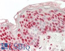 ARX Antibody - Human Skin: Formalin-Fixed, Paraffin-Embedded (FFPE)