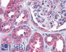 AS3MT Antibody - Anti-AS3MT antibody IHC of human kidney. Immunohistochemistry of formalin-fixed, paraffin-embedded tissue after heat-induced antigen retrieval. Antibody concentration 3.75 ug/ml.
