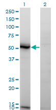 ASAH1 / Acid Ceramidase Antibody - Western blot of ASAH1 expression in transfected 293T cell line. Lane 1: ASAH1 transfected lysate (45 KDa). Lane 2: Non-transfected lysate.