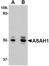 ASAH1 / Acid Ceramidase Antibody - Western blot of ASAH1 in mouse heart tissue lysate with ASAH1 antibody at (A) 1 and (B) 2 ug/ml.