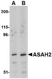 ASAH2 Antibody - Western blot of ASAH2 in 293 cell lysate with ASAH2 antibody at (A) 1 and (B) 2 ug/ml.