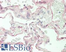 ASAP1 Antibody - Human Lung: Formalin-Fixed, Paraffin-Embedded (FFPE)