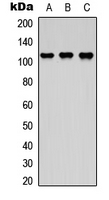 ASAP2 / DDEF2 Antibody - Western blot analysis of DDEF2 expression in HEK293T (A); NS-1 (B); H9C2 (C) whole cell lysates.