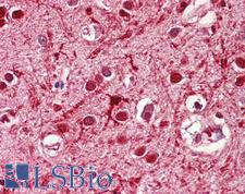 ASCL3 Antibody - Anti-ASCL3 antibody IHC of human brain, cortex. Immunohistochemistry of formalin-fixed, paraffin-embedded tissue after heat-induced antigen retrieval. Antibody dilution 3.75 ug/ml.