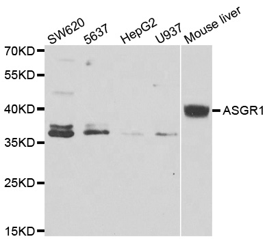 ASGR1 / ASGPR Antibody - Western blot of extracts of various cell lines, using ASGR1 antibody.