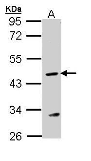 ASL / Argininosuccinate Lyase Antibody - Sample (30 ug of whole cell lysate). A: MOLT4 . 10% SDS PAGE. Arginosuccinate Lyase / ASL antibody diluted at 1:1000