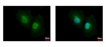ASL / Argininosuccinate Lyase Antibody - ASL antibody detects ASL protein at cytoplasm and nucleus by immunofluorescent analysis. HeLa cells were fixed in 4% paraformaldehyde at RT for 15 min. ASL protein stained by ASL antibody diluted at 1:500.