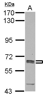 ASNS Antibody - Sample (30 ug of whole cell lysate) A: K562 7.5% SDS PAGE ASNS antibody diluted at 1:1000