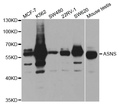ASNS Antibody - Western blot analysis of extracts of various cell lines, using ASNS antibody.