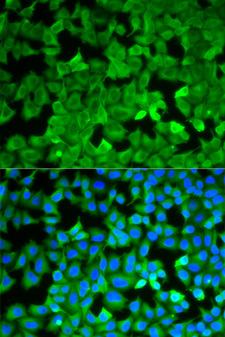 ASNS Antibody - Immunofluorescence analysis of A549 cell using ASNS antibody. Blue: DAPI for nuclear staining.
