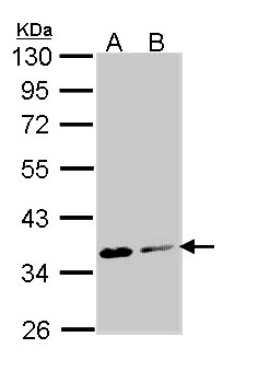 ASPA Antibody - Sample (30 ug of whole cell lysate). A: Molt-4 , B: Raji. 10% SDS PAGE. ASPA antibody diluted at 1:1000.