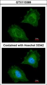 ASPA Antibody - Immunofluorescence of paraformaldehyde-fixed HeLa using Aspartoacylase antibody at 1:200 dilution.