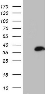ASPA Antibody - HEK293T cells were transfected with the pCMV6-ENTRY control (Left lane) or pCMV6-ENTRY ASPA (Right lane) cDNA for 48 hrs and lysed. Equivalent amounts of cell lysates (5 ug per lane) were separated by SDS-PAGE and immunoblotted with anti-ASPA.