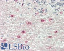 ASPA Antibody - Human Brain, Cerebellum, White Matter: Formalin-Fixed, Paraffin-Embedded (FFPE)