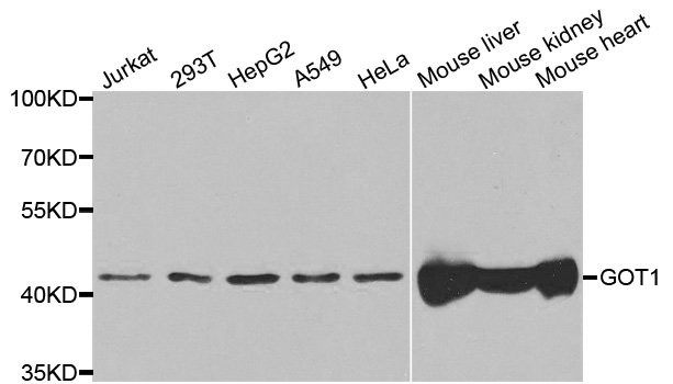 Aspartate Aminotransferase Antibody - Western blot analysis of extracts of various cell lines, using GOT1 antibody.