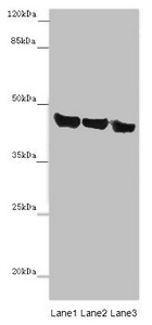 ASPN / Asporin Antibody - Western blot All Lanes: ASPN antibody at 14 ug/ml Lane 1: Mouse heart tissue Lane 2: Mouse liver tissue Lane 3: HL60 whole cell lysate Secondary Goat polyclonal to rabbit IgG at 1/10000 dilution Predicted band size: 43 kDa Observed band size: 43 kDa