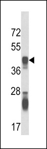 ASS1 / ASS Antibody - Western blot of ASS Antibody in mouse kidney tissue lysates (35 ug/lane). ASS (arrow) was detected using the purified antibody.
