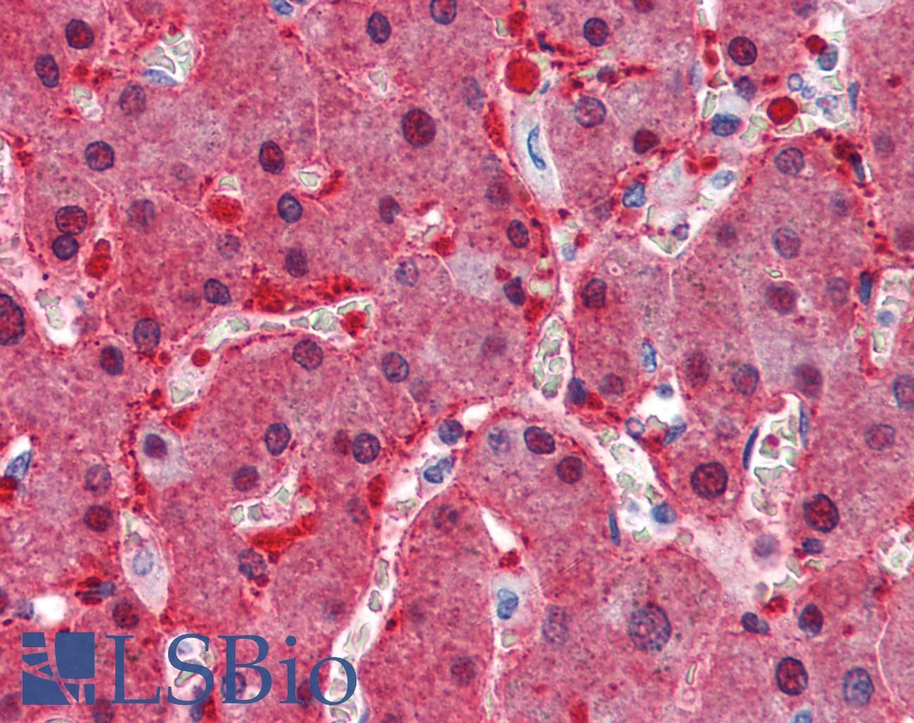 ASS1 / ASS Antibody - Anti-ASS1 antibody IHC of human liver. Immunohistochemistry of formalin-fixed, paraffin-embedded tissue after heat-induced antigen retrieval. Antibody concentration 2.5 ug/ml.