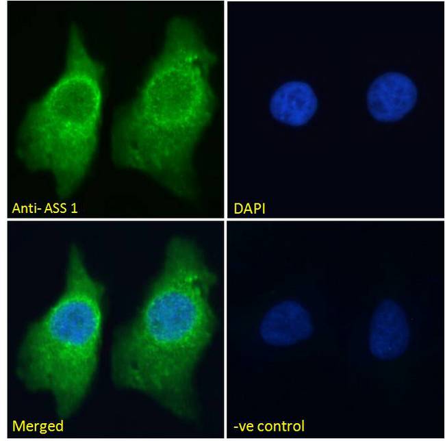 ASS1 / ASS Antibody - Goat Anti-Argininosuccinate synthetase 1 Antibody Immunofluorescence analysis of paraformaldehyde fixed HeLa cells, permeabilized with 0.15% Triton. Primary incubation 1hr (10ug/ml) followed by Alexa Fluor 488 secondary antibody (2ug/ml), showing cytoplasmic staining. The nuclear stain is DAPI (blue). Negative control: Unimmunized goat IgG (10ug/ml) followed by Alexa Fluor 488 secondary antibody (2ug/ml).