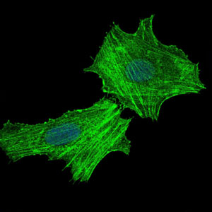 ASS1 / ASS Antibody - Immunofluorescence of HeLa cells using ASS1 mouse monoclonal antibody (green). Blue: DRAQ5 fluorescent DNA dye.