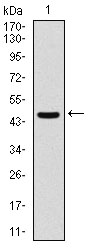 ASS1 / ASS Antibody - Western blot using ASS1 monoclonal antibody against human ASS1 (AA: 40-236) recombinant protein. (Expected MW is 47 kDa)