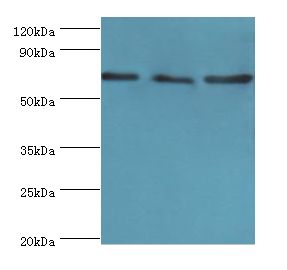 ATAD3A Antibody - Western blot. All lanes: ATAD3A antibody at 4 ug/ml. Lane 1: A549 whole cell lysate. Lane 2: mouse spleen tissue. Lane 3: mouse liver tissue. Secondary antibody: Goat polyclonal to rabbit at 1:10000 dilution. Predicted band size: 71 kDa. Observed band size: 71 kDa Immunohistochemistry.