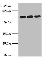 ATAD3A Antibody - Western blot All lanes: ATAD3A antibody at 4µg/ml Lane 1: A549 whole cell lysate Lane 2: Mouse spleen tissue Lane 3: Mouse liver tissue Secondary Goat polyclonal to rabbit IgG at 1/10000 dilution Predicted band size: 72, 67, 58 kDa Observed band size: 72 kDa