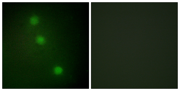 ATF1 Antibody - Immunofluorescence analysis of HUVEC cells, using ATF1 Antibody. The picture on the right is blocked with the synthesized peptide.