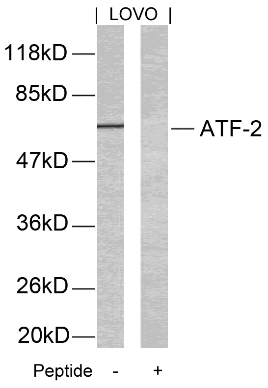 ATF2 Antibody - Western blot of extracts from LOVO cells using ATF2(Ab-69 or 51) antibody and the same antibody preincubated with blocking peptide.