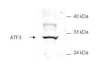 ATF3 Antibody - Anti-ATF3 Antibody - Western Blot. Western blot of mammalian whole cell extract transfected with HA epitope tagged human ATF3. Affinity purified anti-ATF3 detects a band ~31 kD corresponding to recombinant human ATF3. Immunostaining using anti-HA epitope tag antibody confirms the composition of the recombinant band (not shown). The protein was transferred to nitrocellulose in 30 minutes using standard methods. After blocking with 5% goat serum and 0.5% non-fat milk in PBS, the membrane was probed with the primary antibody diluted 1:200 in 0.2X blocking buffer in PBS overnight at 4C. Reaction was followed by washes and reaction with a 1:5000 dilution of IRDye800 conjugated Gt-a-Rabbit IgG [H&L] (code for 30 min at room temperature. LICORs Odyssey Infrared Imaging System was used to scan and process the image. Other detection systems will yield similar results.