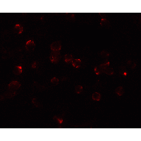 ATF6 Antibody - Immunofluorescence of ATF6 in MCF7 cells with ATF6 Antibody at 20 µg/mL.