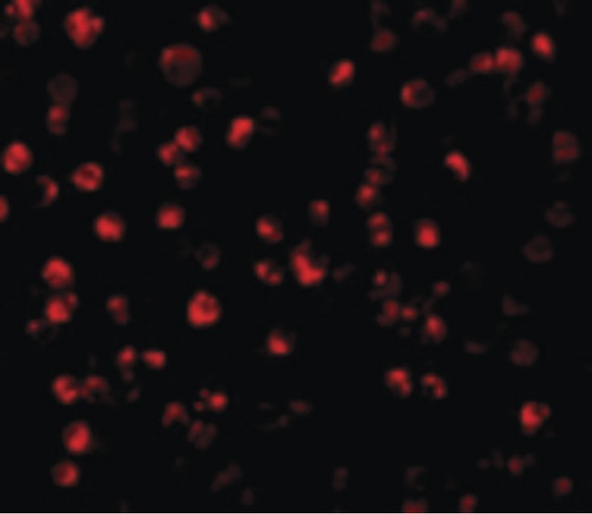 ATF6 Antibody - Immunofluorescence of ATF6 in MCF7 cells with ATF6 antibody at 10 ug/ml.