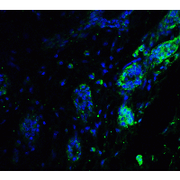 ATF6 Antibody - Immunofluorescence of ATF6 in human breast tissue with ATF6 antibody at 20 µg/ml.Green: ATF6 Antibody  Blue: DAPI staining