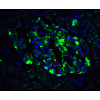 ATF6 Antibody - Immunofluorescence of ATF6 in human pancreas tissue with ATF6 antibody at 20 µg/ml.Green: ATF6 Antibody  Blue: DAPI staining