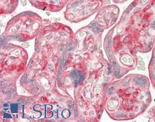 ATF6 Antibody - Human Placenta: Formalin-Fixed, Paraffin-Embedded (FFPE)