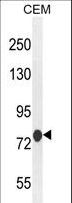 ATF7IP2 Antibody - MCAF2 Antibody western blot of CEM cell line lysates (35 ug/lane). The MCAF2 antibody detected the MCAF2 protein (arrow).