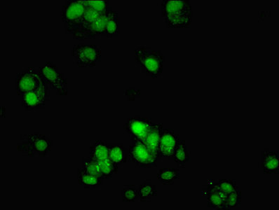 ATG10 Antibody - Immunofluorescent analysis of MCF-7 cells using ATG10 Antibody at dilution of 1:100 and Alexa Fluor 488-congugated AffiniPure Goat Anti-Rabbit IgG(H+L)