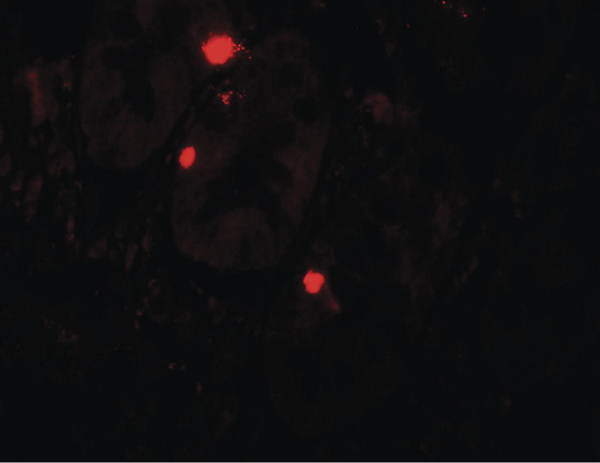ATG14 Antibody - Immunofluorescence of ATG14 in human small intestine tissue with ATG14 antibody at 20 ug/ml.