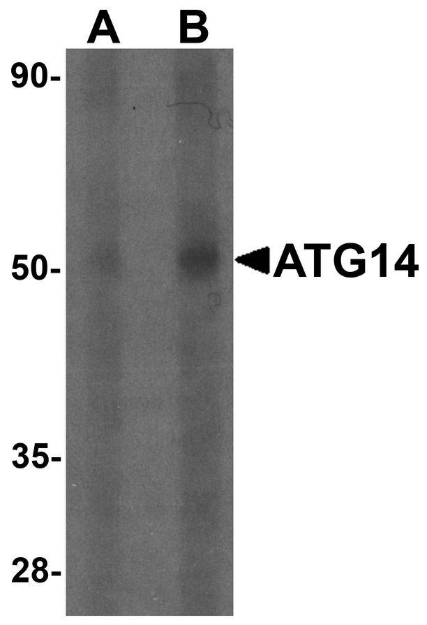 ATG14 Antibody - Western blot analysis of ATG14 in human small intestine tissue lysate with ATG14 antibody at (A) 1 and (B) 2 ug/ml.