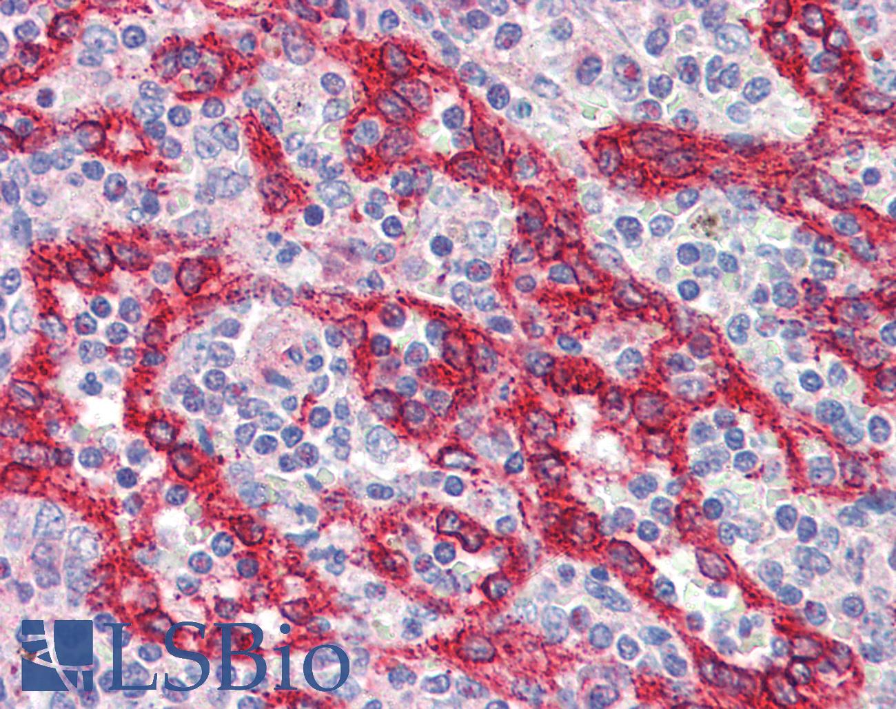 ATG16L1 / ATG16L Antibody - Anti-ATG16L1 antibody IHC of human spleen. Immunohistochemistry of formalin-fixed, paraffin-embedded tissue after heat-induced antigen retrieval. Antibody concentration 5 ug/ml.  This image was taken for the unconjugated form of this product. Other forms have not been tested.