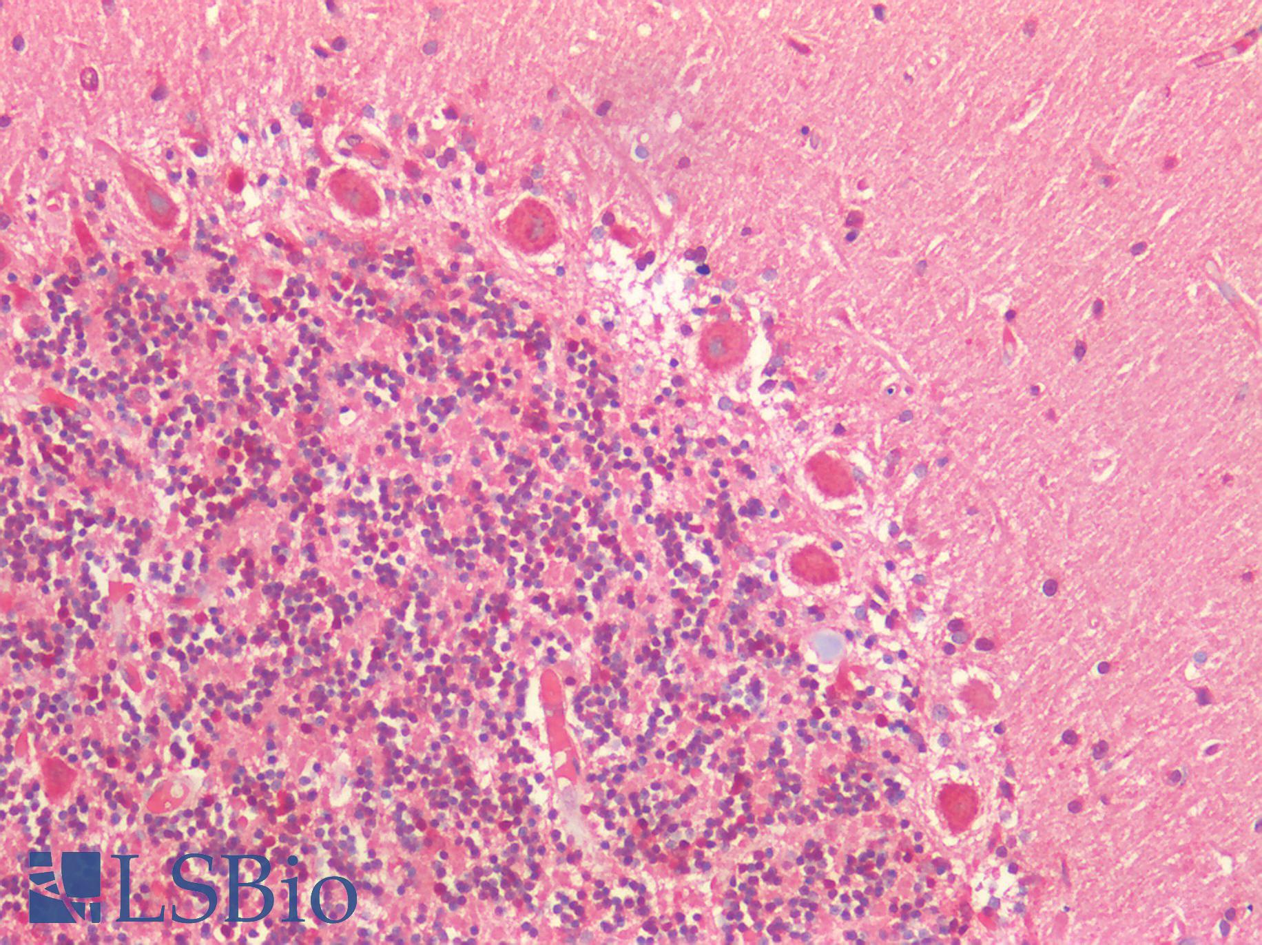ATG16L1 / ATG16L Antibody - Human Brain, Cerebellum: Formalin-Fixed, Paraffin-Embedded (FFPE)
