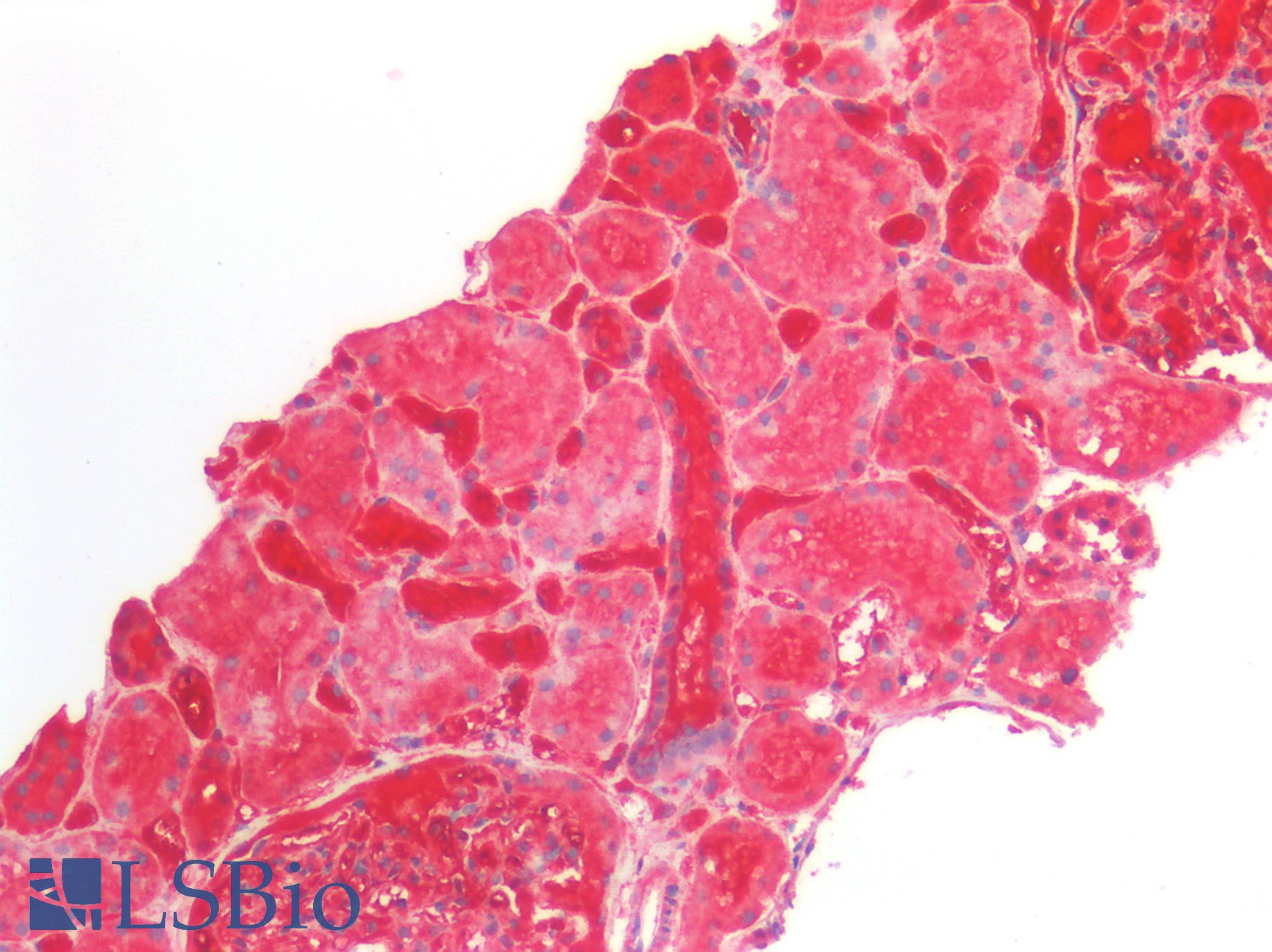 ATG16L1 / ATG16L Antibody - Human Kidney: Formalin-Fixed, Paraffin-Embedded (FFPE)