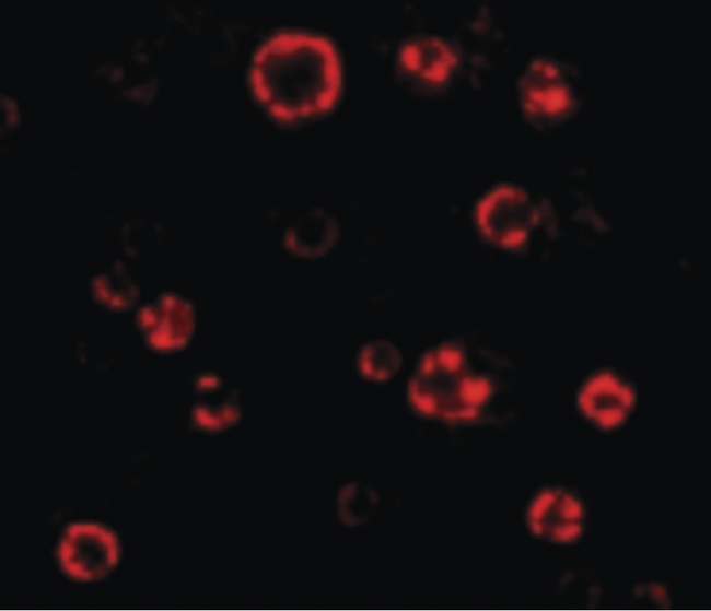 ATG16L1 / ATG16L Antibody - Immunofluorescence of ATG16 in HeLa cells with ATG16 antibody at 4.75 ug/ml.