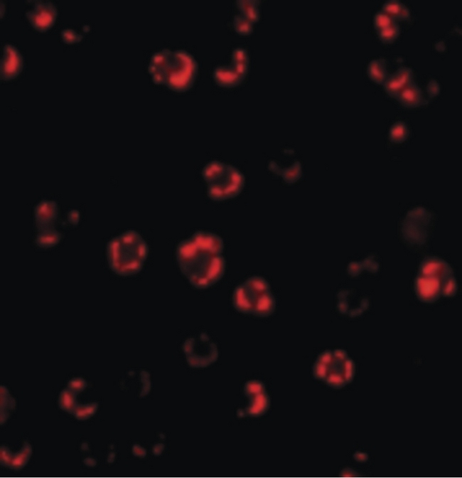 ATG16L1 / ATG16L Antibody - Immunofluorescence of ATG16 in HeLa cells with ATG16 antibody at 4 ug/ml.