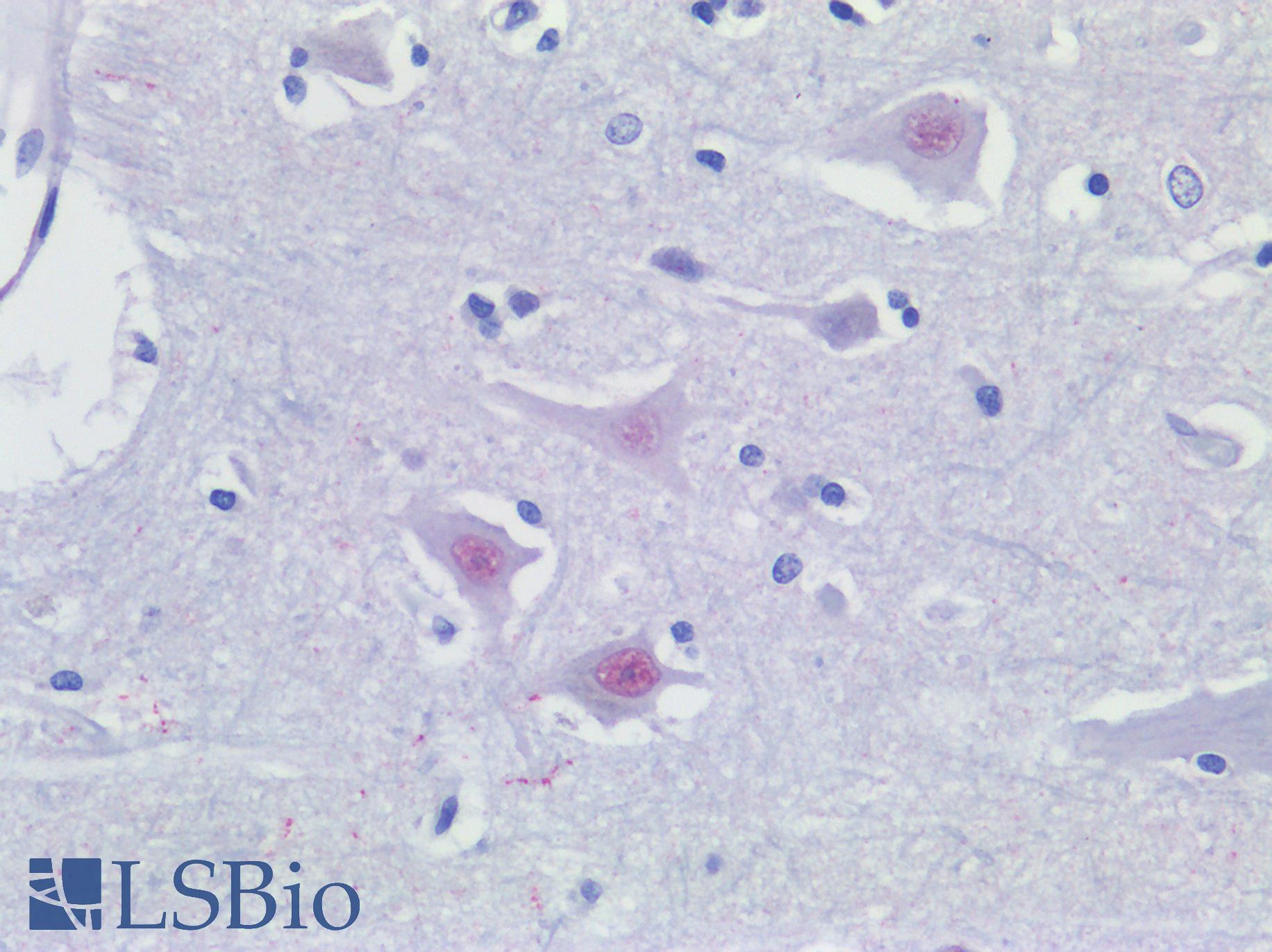 ATG16L1 / ATG16L Antibody - Human Brain, Cortex Pyramidal Cells: Formalin-Fixed, Paraffin-Embedded (FFPE)