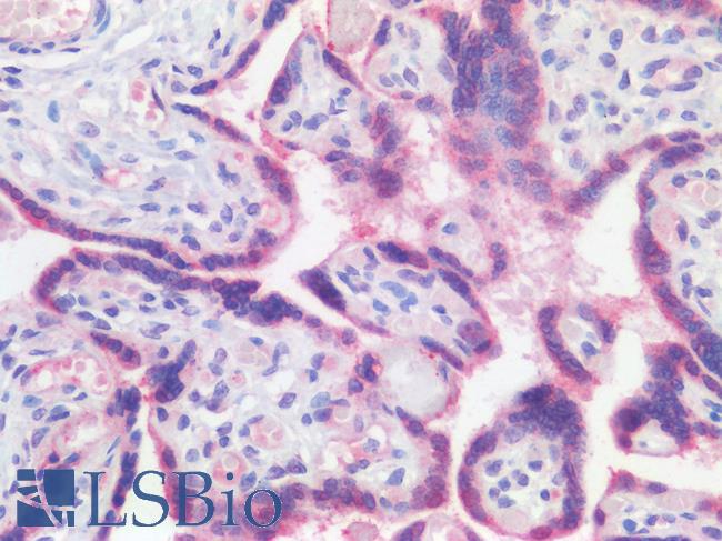 ATG16L1 / ATG16L Antibody - Human Placenta, Trophoblasts: Formalin-Fixed, Paraffin-Embedded (FFPE)