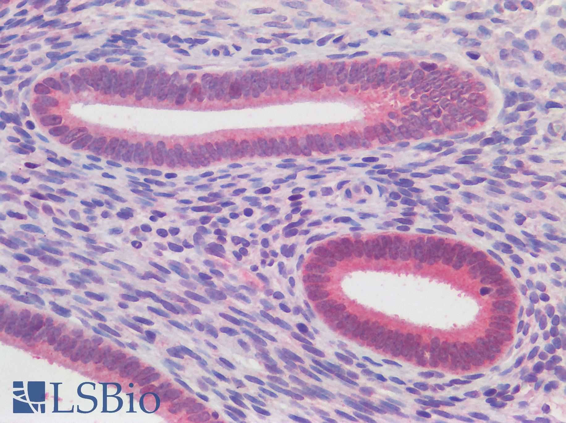 ATG16L1 / ATG16L Antibody - Human Uterus, Endrometrium: Formalin-Fixed, Paraffin-Embedded (FFPE)